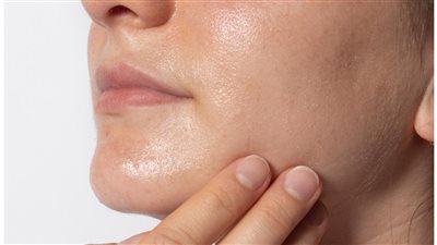 ماسكات من الطبيعة للبشرة الدهنية، أبرزها العسل بالشوفان