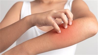 منها الجفاف والاكزيما، أسباب حساسية الجلد