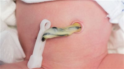 نصائح مهمة للأمهات للعناية بالطفل حديث الولادة 