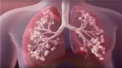  الصحة تحذر: تربية الطيور والحمام من مسببات تليف الرئة (فيديو) 