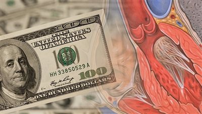 الدولار يهدد مرضى صمامات القلب.. أطباء قلب لـ”فيتو”: ارتفاع سعر صمام القلب لأكثر من 30 ألف جنيه و60 ألفا فى السوق السوداء
