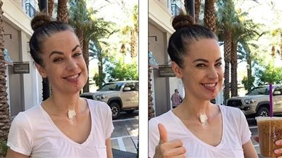 طبيب الأسنان أنقذ حياة عارضة الأزياء