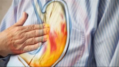 علاج حموضة المعدة، اتباع نظام غذائي قليل الدسم والتوابل أيضا 