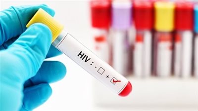 الأطباء: مستشفى قنا العام تعامل باحترافية مع ولادة قيصرية لمصابة بالإيدز 