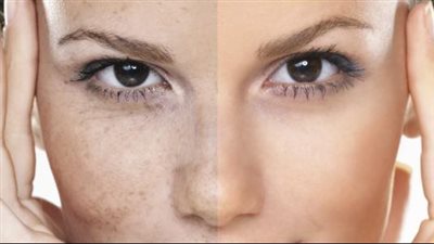 وصفة طبيعية لترطيب البشرة بعمق فى الشتاء