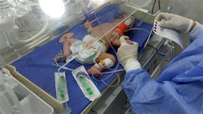 فحص 31238 طفلا من الأمراض الوراثية بالشرقية 