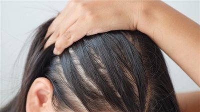 وصفة طبية لتكثيف الشعر الخفيف وإنبات الفراغات 