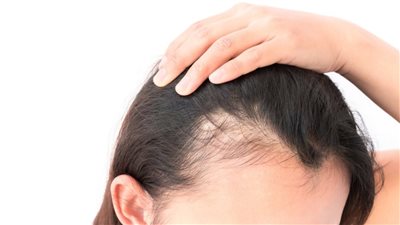 وصفة طبيعية لعلاج تساقط الشعر والبيبي هير