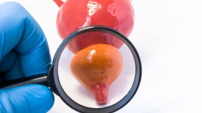 5 أعراض رئيسية تدل على الإصابة بأمراض البروستاتا
