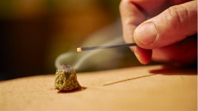  حكم التداوي بالكي؟ الإفتاء تجيب