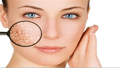 أسباب جفاف البشرة، وطرق ترطيبها بالخيار والشوفان وزيت جوز الهند