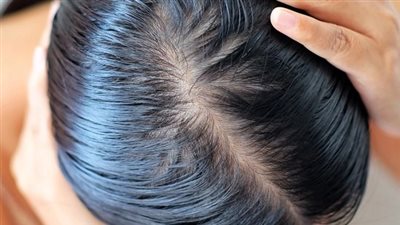 وصفة طبيعية لتغذبة وترطيب الشعر الدهني 