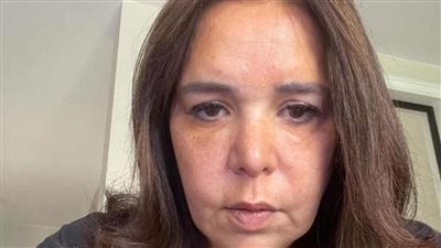 لمياء حلاوة: أرسلت إلى شركة لاكتاليس بفرنسا لإفادتى عن التحقيق القضائى في فضيحة تلوث الألبان العالمية عام 2018