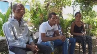بسبب مرض غريب، عائلة في جمهورية الدومنيكان تشبه الكائنات الفضائية