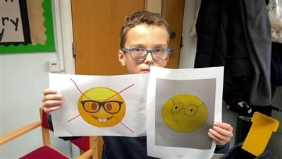 بسبب أسنان الأرنب، طفل يطالب بتغيير 