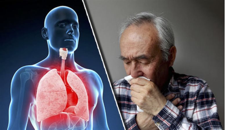 علاج التهاب الشعب