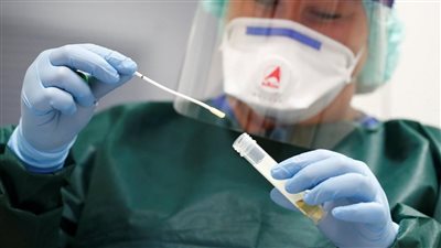 فيروس وريدي نادر يصيب شابا في بيرو