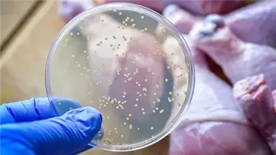 أهمها الأكل غير مطبوخ، أسباب وأعراض الإصابة بالسالمونيلا