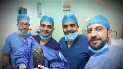 كان عندها هوس لأكله.. استخراج 6 كيلو شعر من بطن فتاة في عملية نادرة | صور