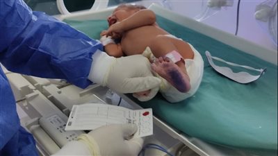 الصحة توضح أهم التطعيمات المتوفرة لحديثي الولادة مجانا 