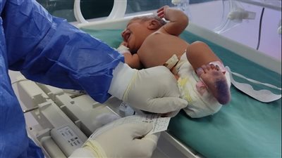الصحة: فحص 45 ألف طفل من حديثي الولادة للكشف المبكر عن الأمراض الوراثية