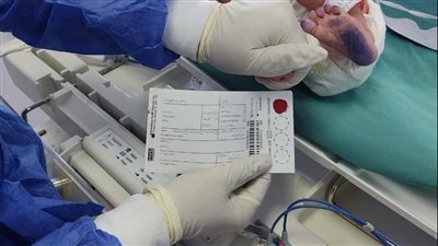 الصحة: فحص 70 ألف طفل حديث الولادة ضمن مبادرة الكشف المبكر عن الأمراض الوراثية 