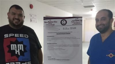 جراحة نادرة لاستئصال ورم حميد بالكبد لسيدة في مستشفي بلقاس بالدقهلية 