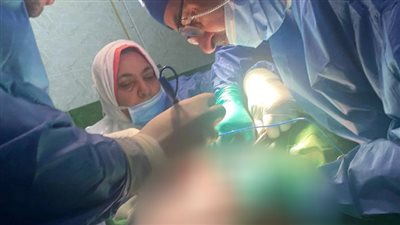 الفريق الطبي بمستشفى الدلنجات ينجح في إزالة ورم حميد بالرقبة لأحد المرضى (صور)