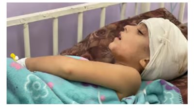 فقدت يديها كاملة.. مأساة طفلة فلسطينية دمر الاحتلال حلمها 