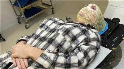  الحالة الوحيدة في العالم، فتاة بريطانية تعيش بـ 