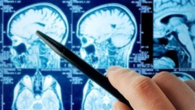 علماء يكتشفون تغيرات مثيرة للقلق في أدمغة المراهقين الذين يتناولون الكحول