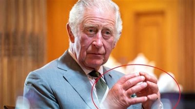 يعاني من التهاب المفاصل، أصابع الملك تكشف حالته الصحية