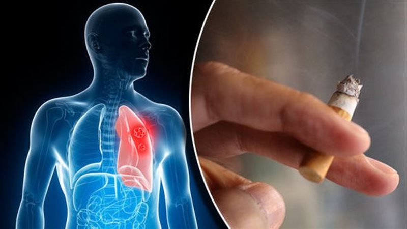 خطورة التدخين، فيتو