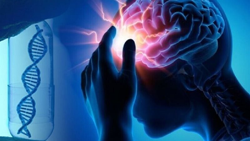 الجلطة الدماغية،