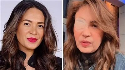 رؤية مزدوجة، صداع، ألم العين، طنين الأذن، مرض غريب تعاني منه ممثلة مكسيكية