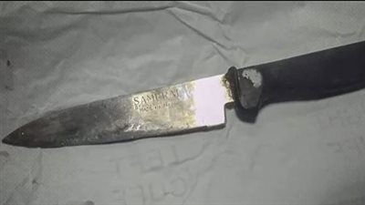  فريق طبي بمستشفى المنصورة الدولي ينجح في استخراج سكين مطبخ من عمق قولون مريض 