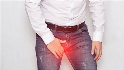 أعراض ومضاعفات الإصابة بدوالي الخصية، ومتى تسبب العقم؟