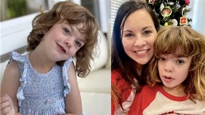 طفلة تعاني من مرض نادر يصيب 