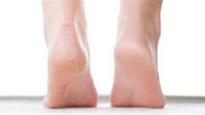 أسباب ألم كعب القدم ومضاعفاته