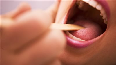 أسباب التهاب الحلق عند الأطفال وأعراضه ومخاطر الإصابة به 