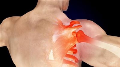 كيف تعرف إذا تعرض كتفك للخلع؟