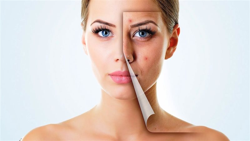 وصفات طبيعية لعلاج