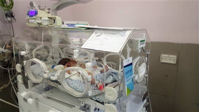 ولادة حيوان برأس إنسان في تايلاند، وبيطريون يكشفون السبب (صورة)