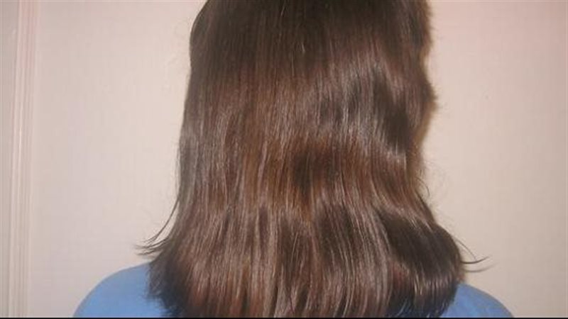 زيادة طول الشعر،