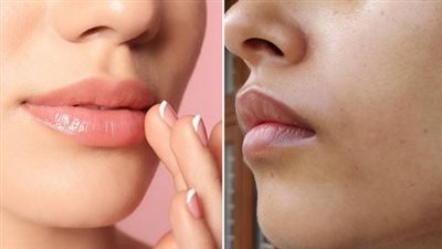 وصفة طبيعية للتخلص من الاسمرار حول الفم 