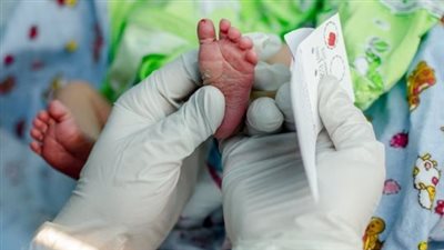 صحة المصريين في خطر.. عجز فى الألبان العلاجية يهدد مرضى الـ«pku».. سعر عبوة اللبن يصل لـ1000 جنيه.. والدكتور كريم كرم: نستورد من الخارج والشركات الأجنبية تشترط الدفع بالدولار مقدما