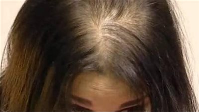 وصفة طبيعية لعلاج الشعر الخفيف وتغذية الجذور