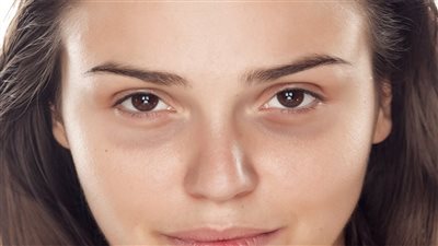 علاج الهالات السوداء حول العينين بالوصفات الطبيعية