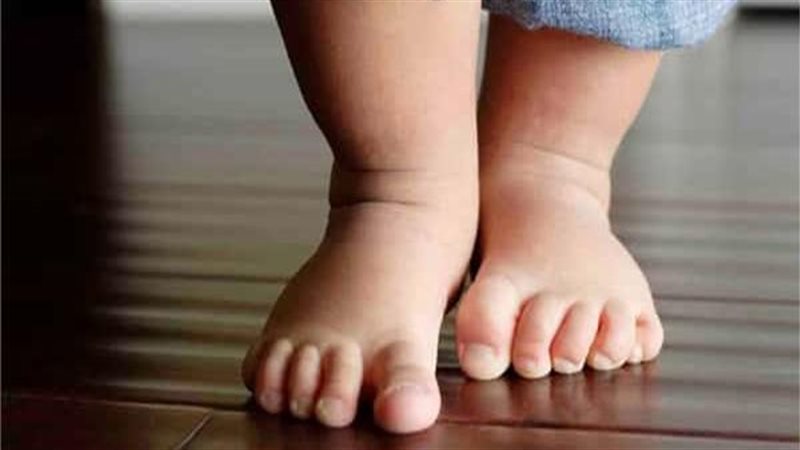 برودة أطراف الأطفال،