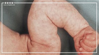 علامات تظهر على رضيعك يجب الانتباه إليها (إنفوجراف)